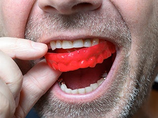 man putting in red mouth guard