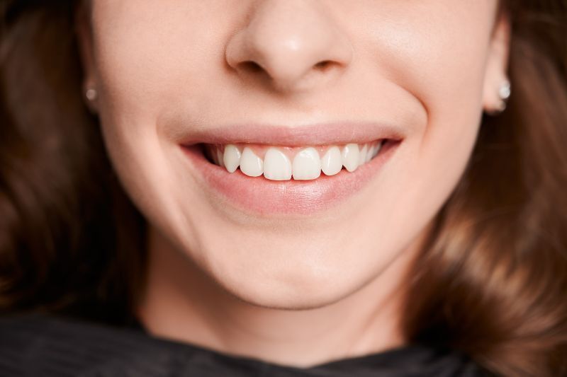 How Long Does Cosmetic Dental Treatment Last?