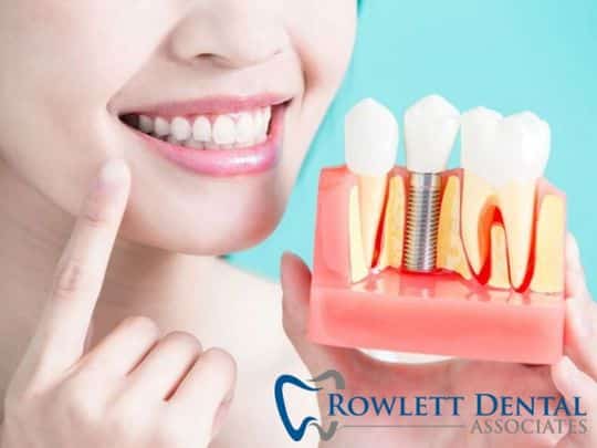 Dental Implants Rowlett