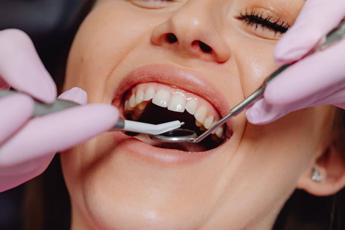 Bring Your Smile Back to Life with Restorative Dentistry Magic