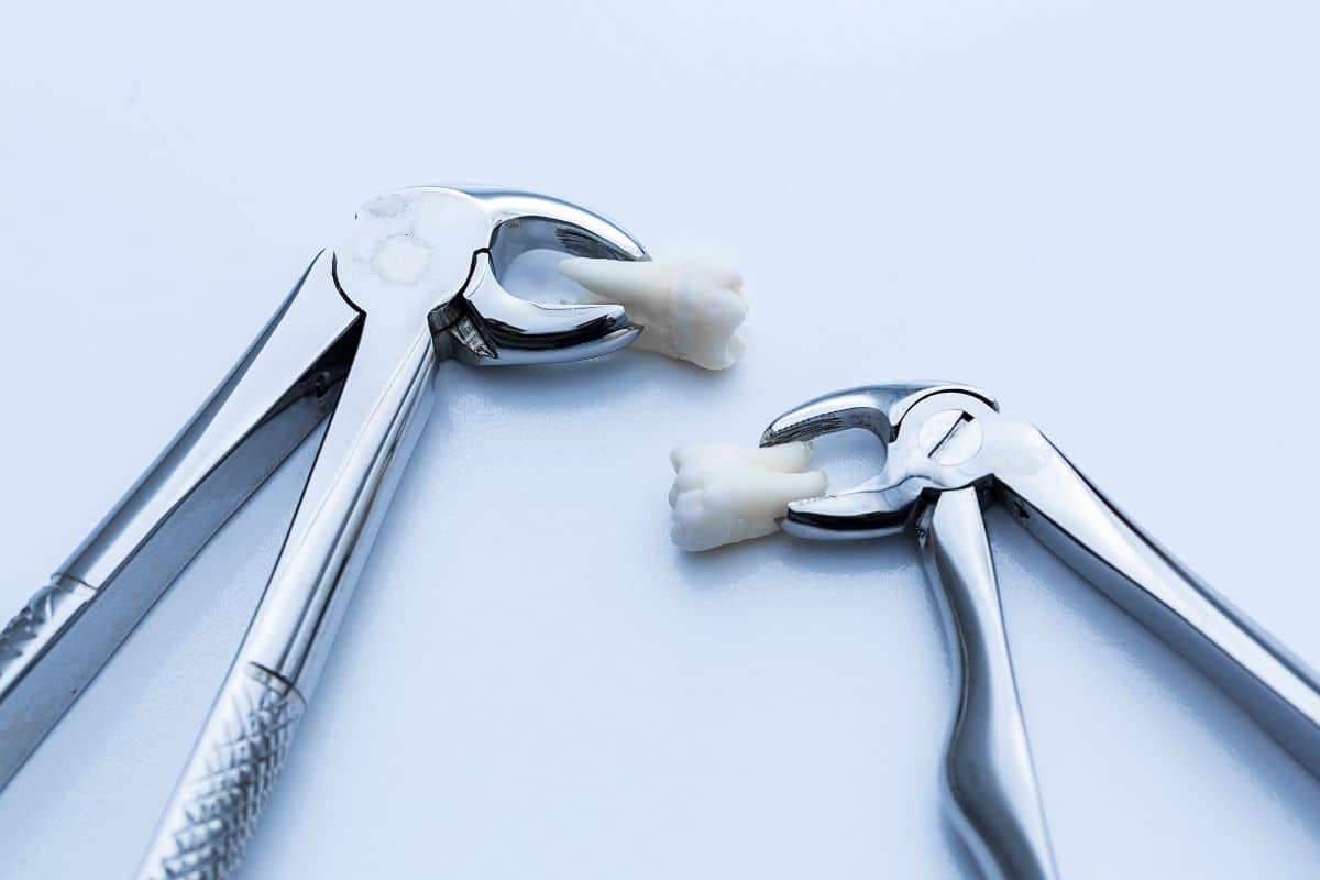 Can Wisdom Teeth Regrow After Removal? Exploring the Facts and Myths About Wisdom Teeth Regrowth