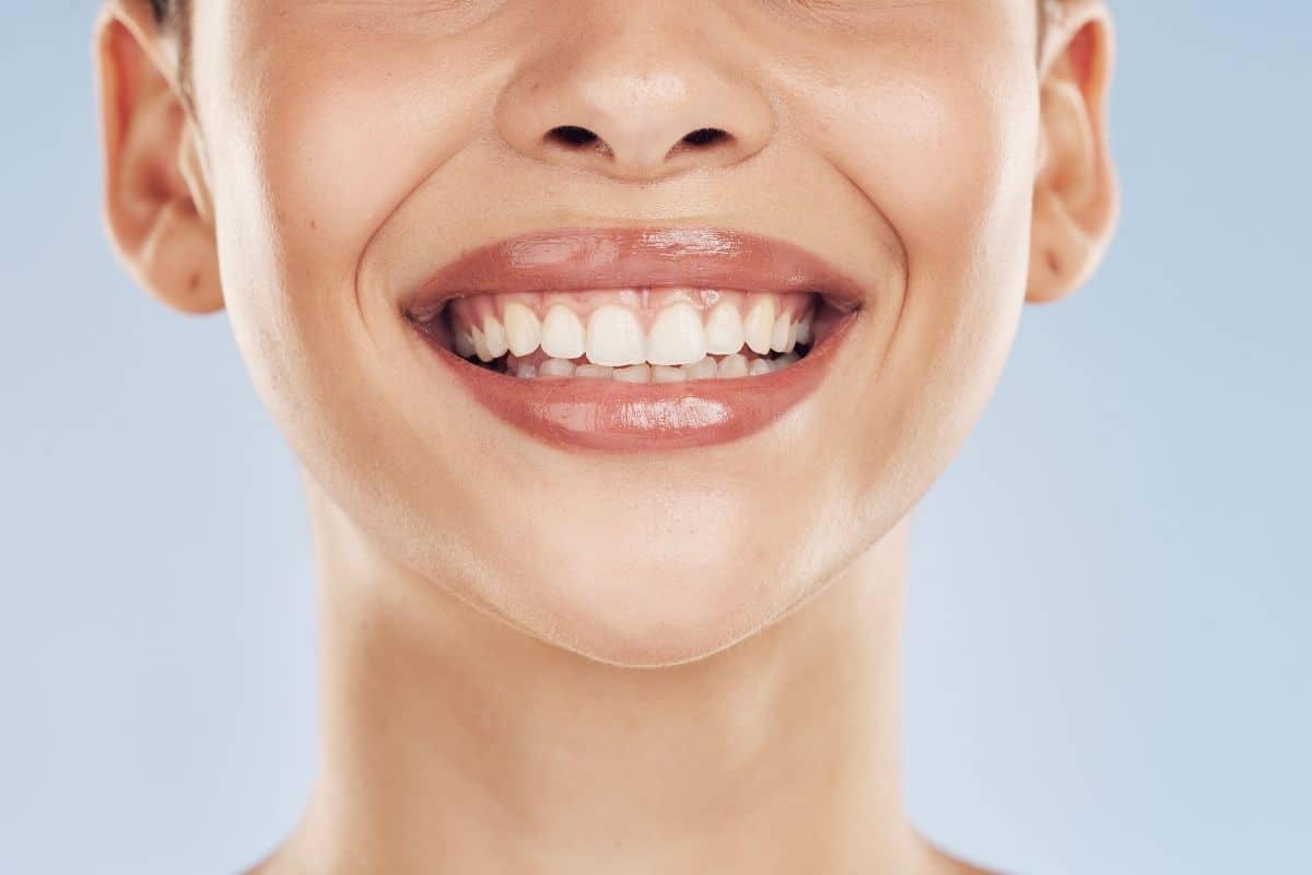 teeth whitening
