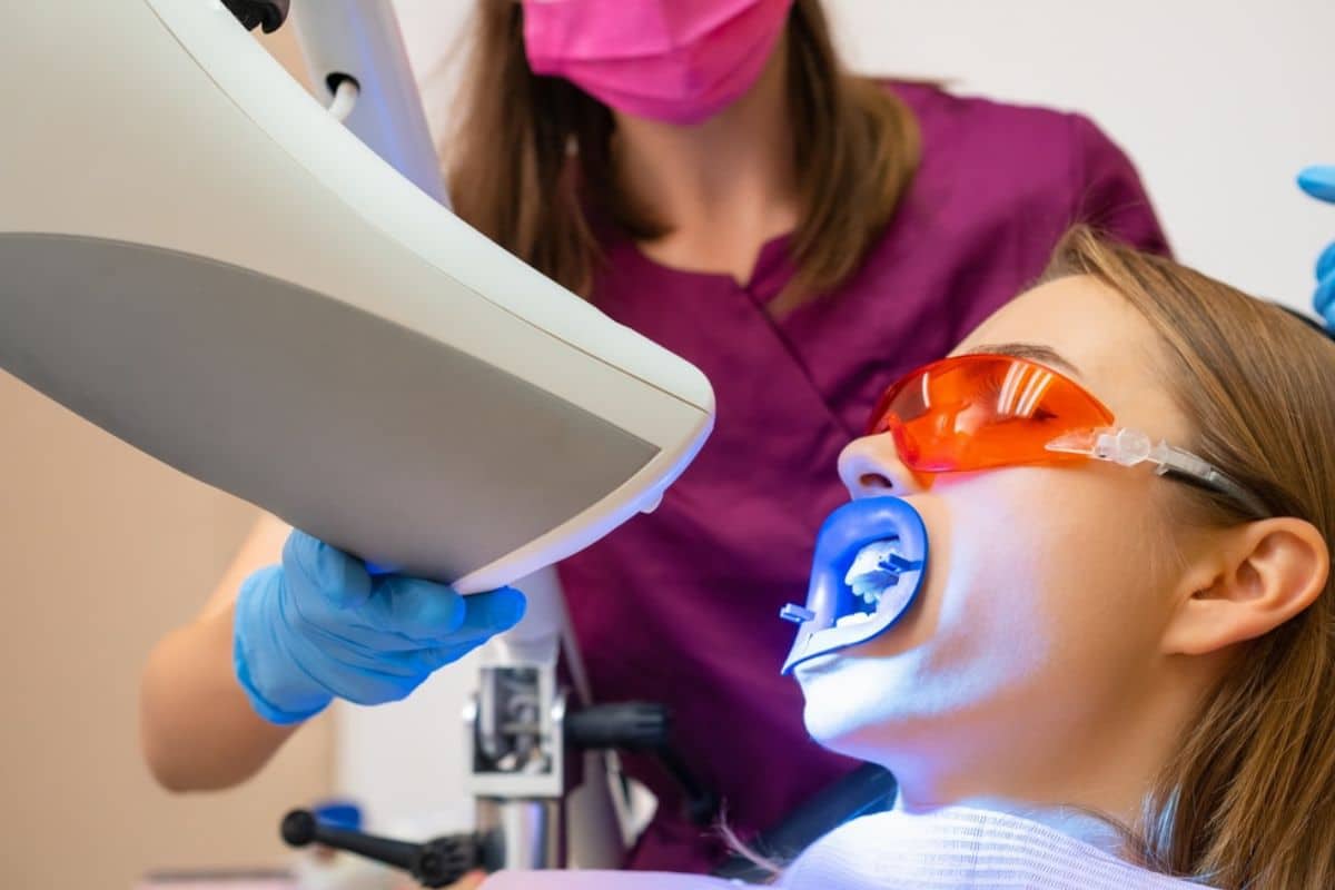 How Often Can You Whiten Your Teeth Safely?