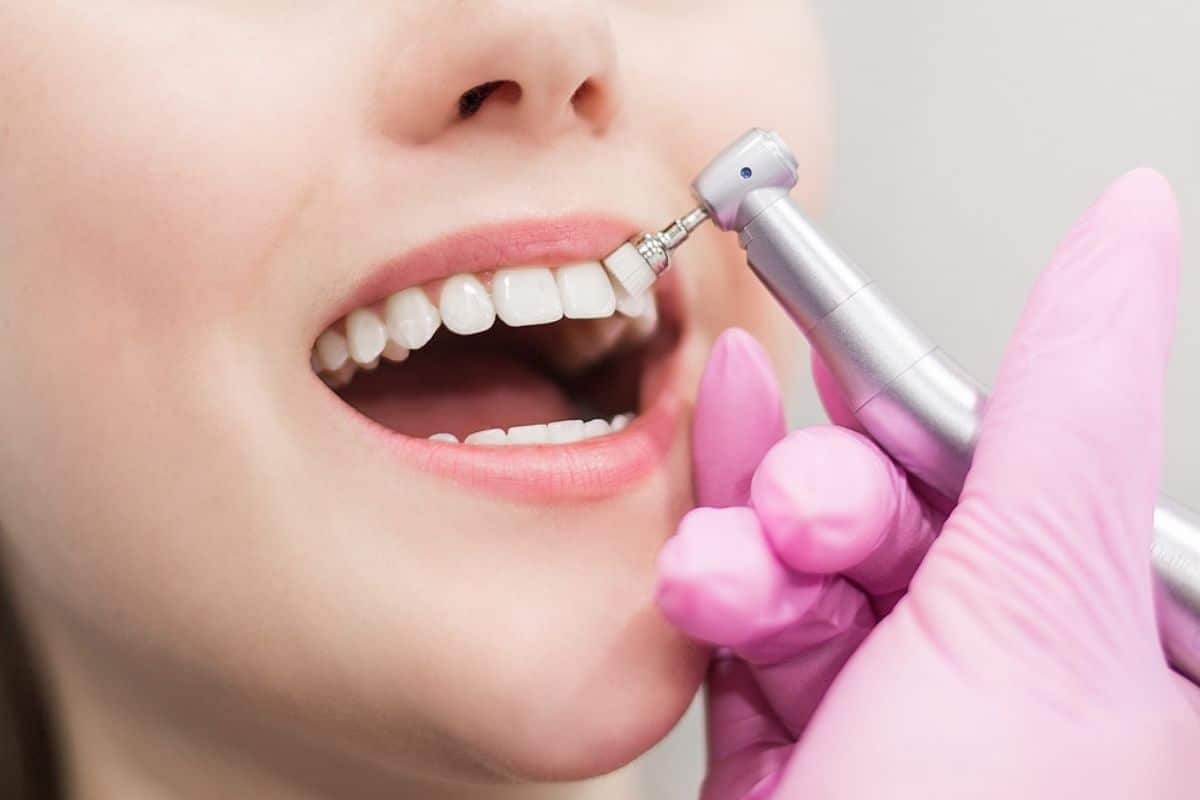 Can Teeth Whitening Damage Enamel?