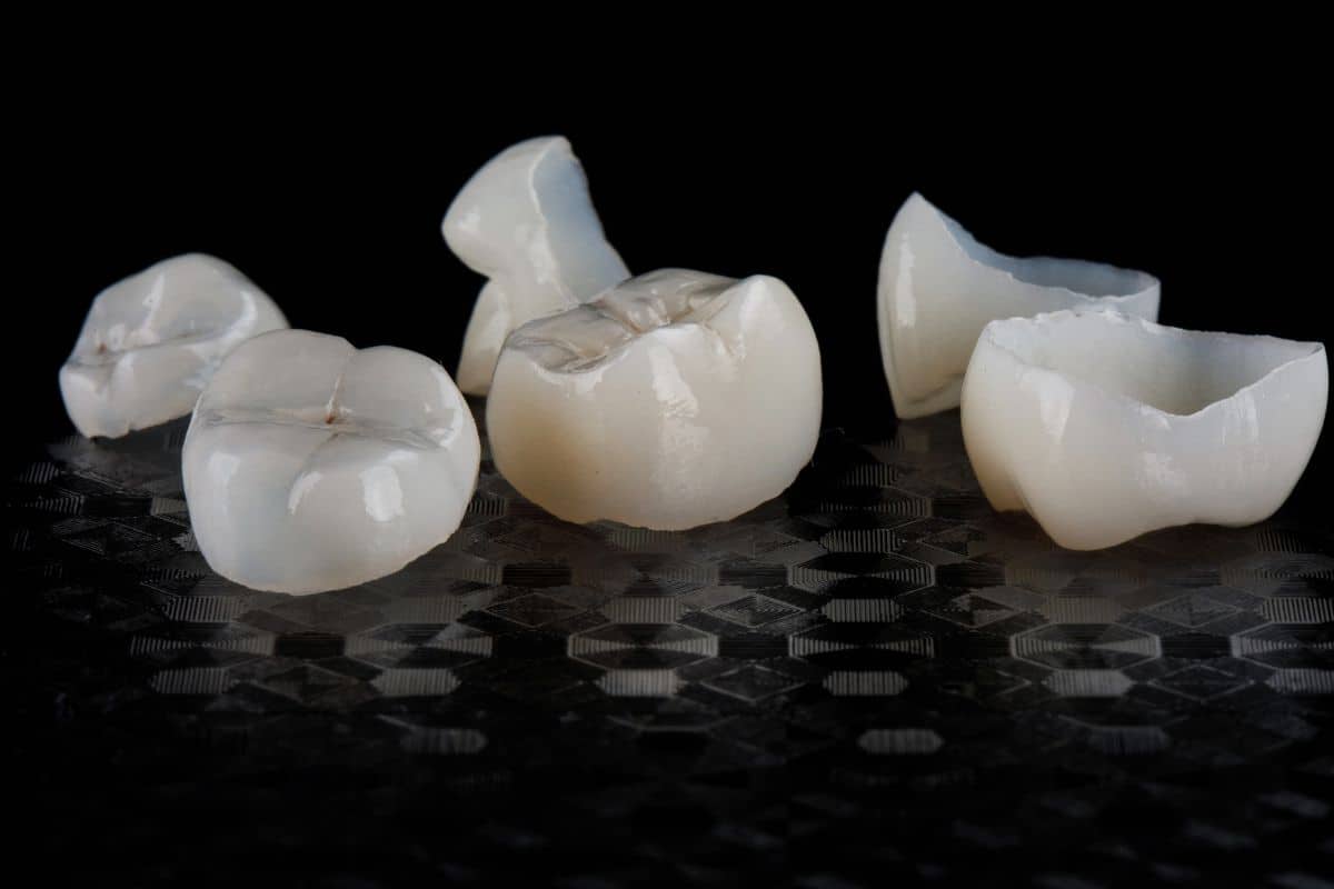 What Should You Do If Your Dental Crown Falls Off ?