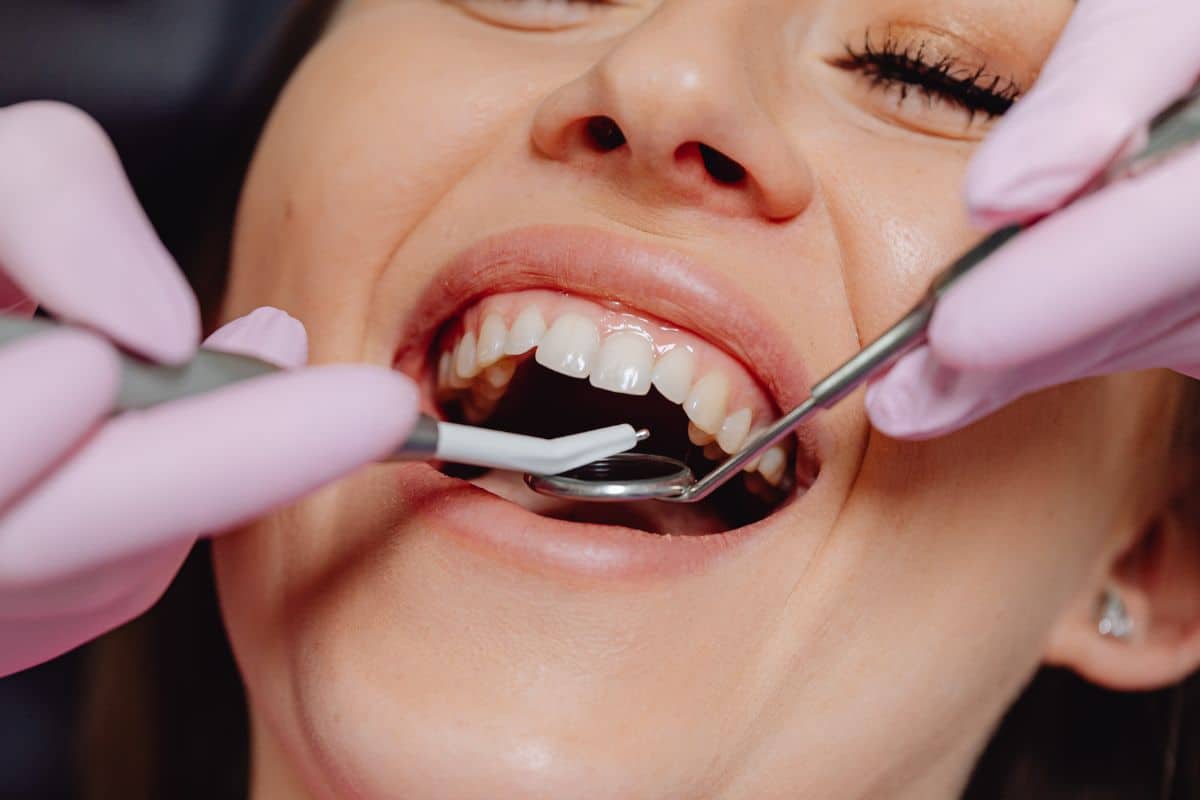 How to Prepare for Your Restorative Dentistry Appointment?
