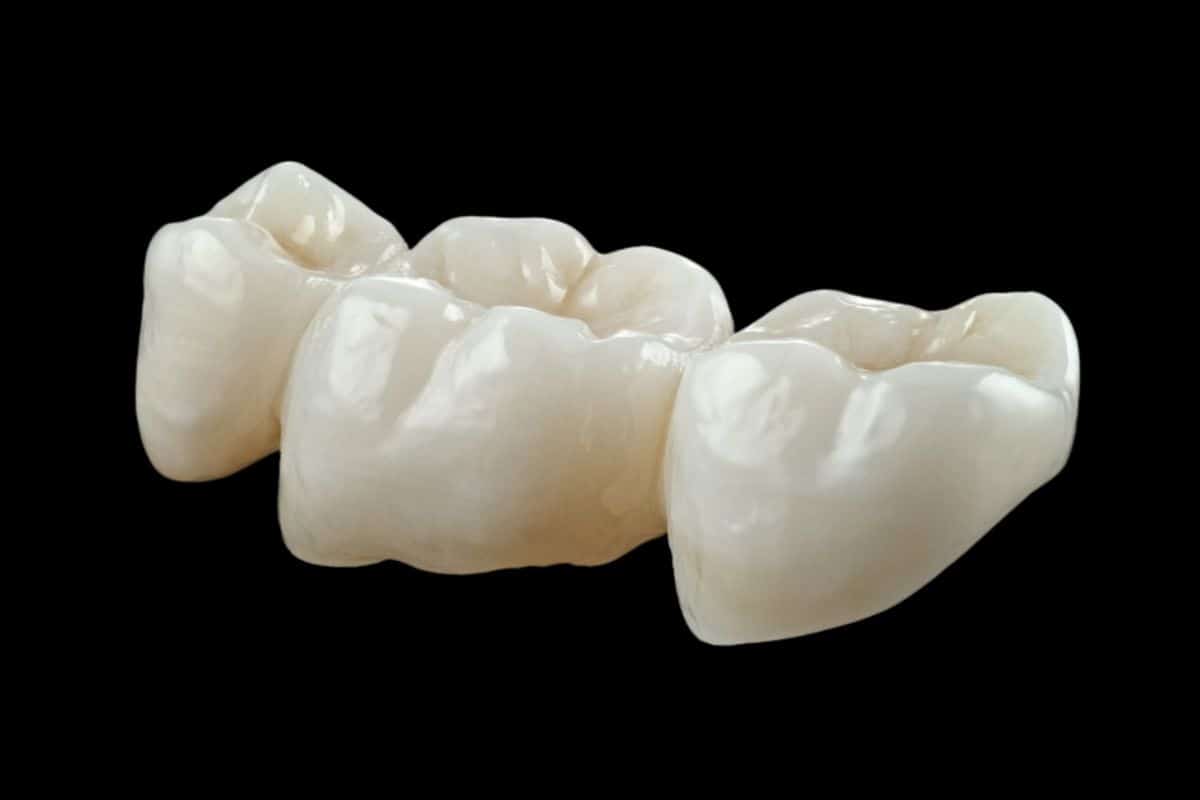 How to Reuse a Broken Dental Crown Effectively?