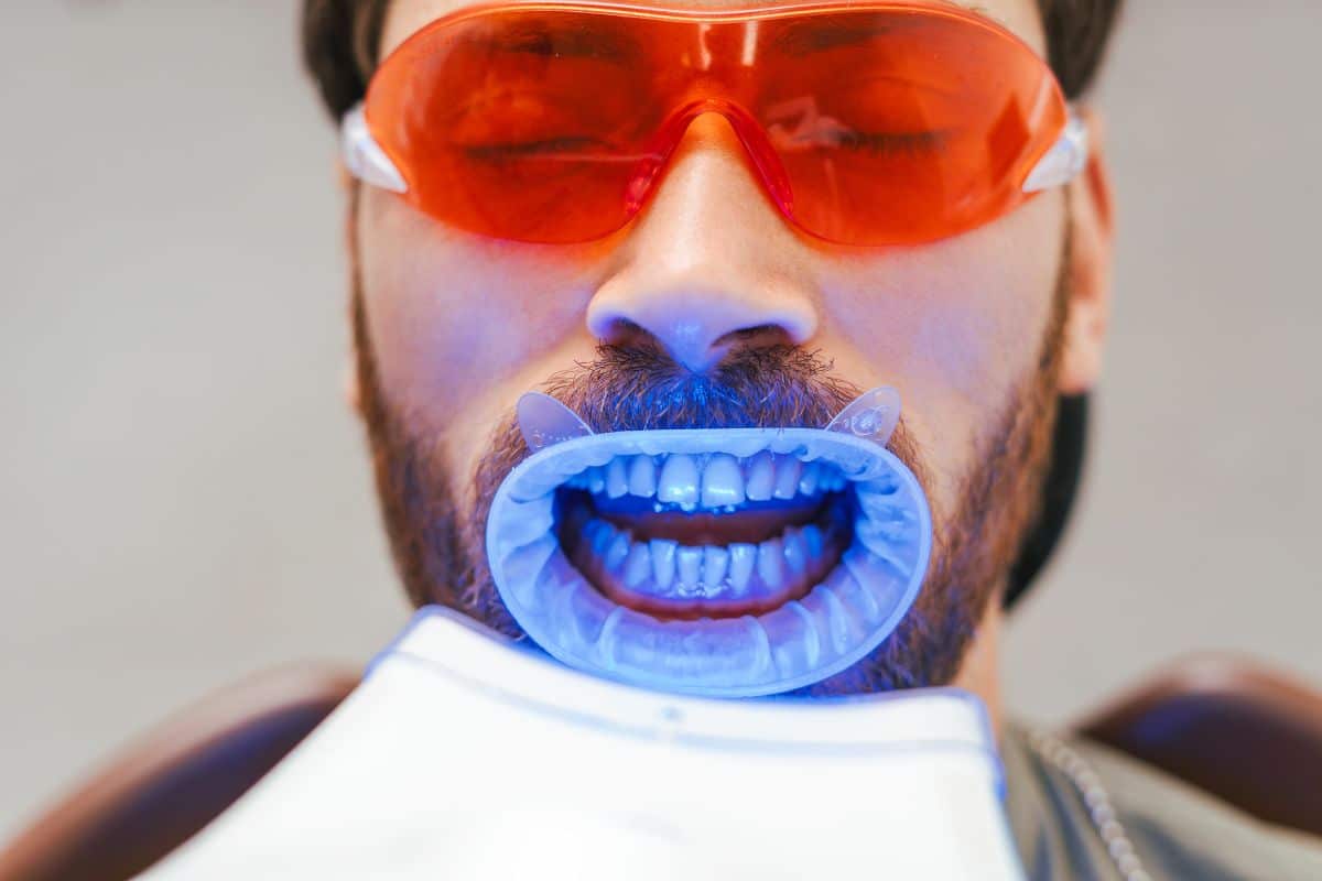 How to Maintain Your Teeth Whitening Results?