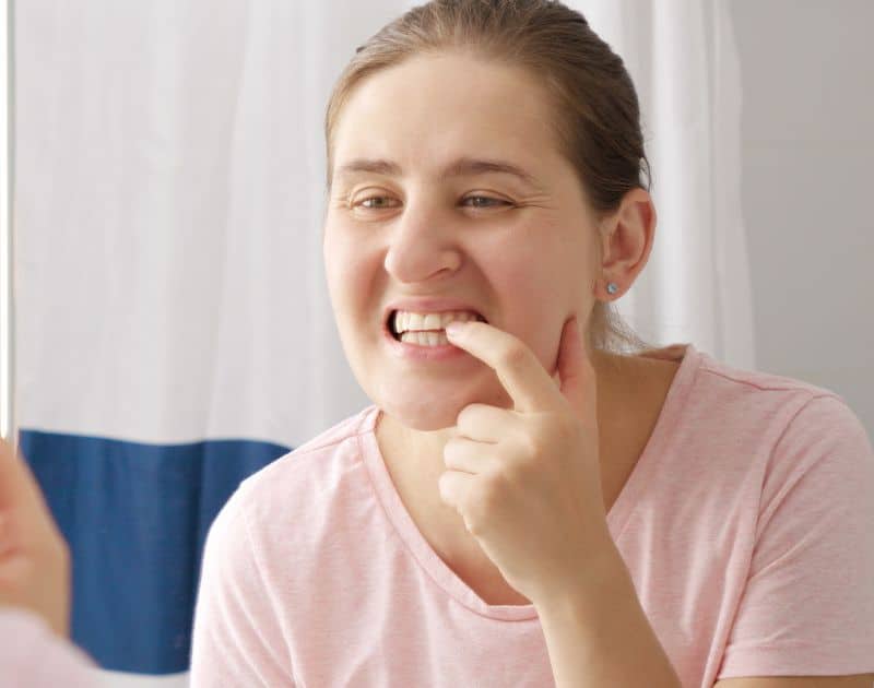 How To Treat Tooth Decay At The Gum Line?