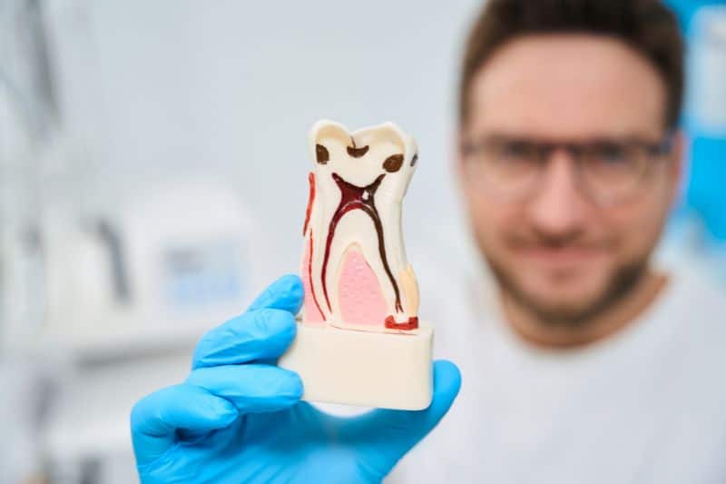 Root canal Treatment