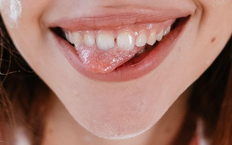 Why Do I Keep Getting Bumps on My Tongue?